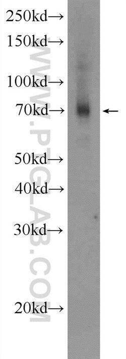 FDXACB1 Rabbit anti-Human, Polyclonal, Proteintech 150 &mu;L | Buy Online | Proteintech Group Inc | Fisher Scientific