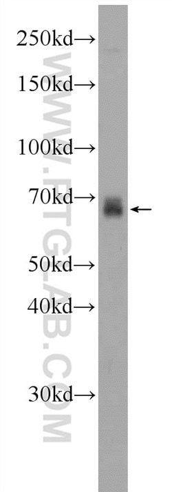 FDXACB1 Rabbit anti-Human, Polyclonal, Proteintech 150 &mu;L | Buy Online | Proteintech Group Inc | Fisher Scientific