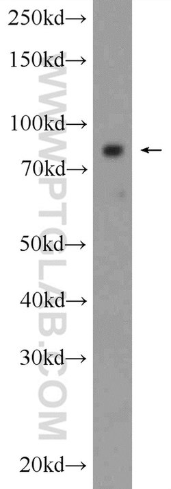 AKAP4 Rabbit anti-Human, Polyclonal, Proteintech 20 &mu;L; Unconjugated:Antibodies,