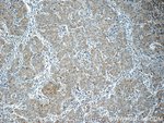Thumbnail_KHDC3L Rabbit anti-Human, Polyclonal, Proteintech 20 &mu;L; Unconjugated:Antibodies,
