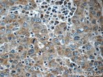 Thumbnail_KHDC3L Rabbit anti-Human, Polyclonal, Proteintech 20 &mu;L; Unconjugated:Antibodies,