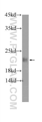 Thumbnail_KHDC3L Rabbit anti-Human, Polyclonal, Proteintech 20 &mu;L; Unconjugated:Antibodies,