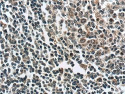 ZC3H12D Rabbit anti-Human, Polyclonal, Proteintech 150 &mu;L; Unconjugated:Antibodies,
