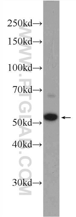 ZC3H12D Rabbit anti-Human, Polyclonal, Proteintech 150 &mu;L; Unconjugated:Antibodies,