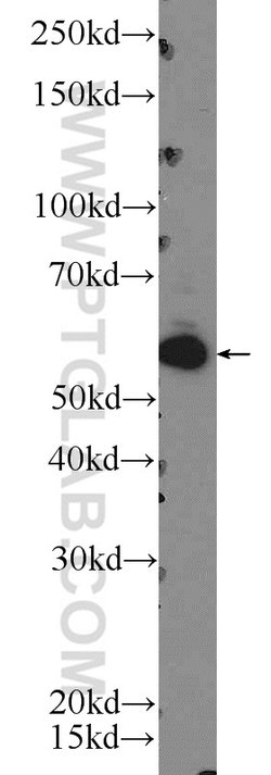 ZC3H12D Rabbit anti-Human, Polyclonal, Proteintech 150 &mu;L; Unconjugated:Antibodies,