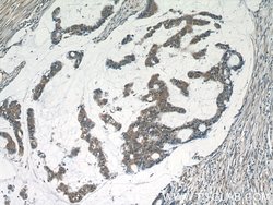 RelB Rabbit anti-Human, Rat, Polyclonal, Proteintech:Antibodies:Primary