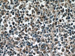 RelB Rabbit anti-Human, Rat, Polyclonal, Proteintech:Antibodies:Primary