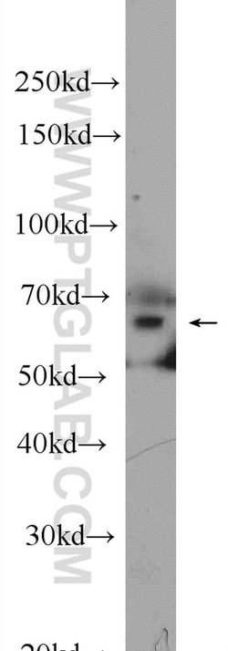 RelB Rabbit anti-Human, Rat, Polyclonal, Proteintech:Antibodies:Primary