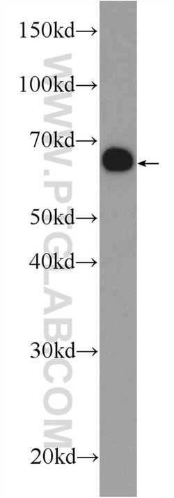 UROC1 Rabbit anti-Human, Mouse, Polyclonal, Proteintech:Antibodies:Primary