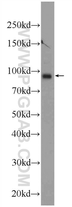 TMCC2 Rabbit anti-Human, Mouse, Rat, Polyclonal, Proteintech:Antibodies:Primary