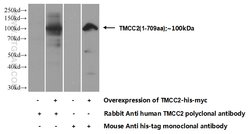 TMCC2 Rabbit anti-Human, Mouse, Rat, Polyclonal, Proteintech:Antibodies:Primary