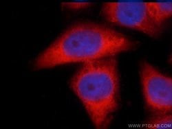 LPP Rabbit anti-Human, Mouse, Polyclonal, Proteintech 150 &mu;L; Unconjugated:Antibodies,
