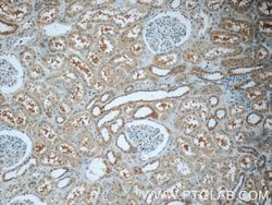 LPP Rabbit anti-Human, Mouse, Polyclonal, Proteintech 150 &mu;L; Unconjugated:Antibodies,