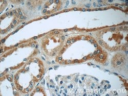 Proteintech LPP Rabbit anti-Human, Mouse, Polyclonal, Proteintech