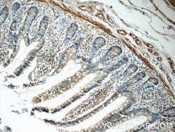 LPP Rabbit anti-Human, Mouse, Polyclonal, Proteintech 150 &mu;L; Unconjugated:Antibodies,