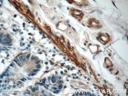 LPP Rabbit anti-Human, Mouse, Polyclonal, Proteintech 150 &mu;L; Unconjugated:Antibodies,