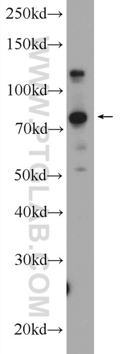 KIAA1530 Rabbit anti-Human, Polyclonal, Proteintech:Antibodies:Primary