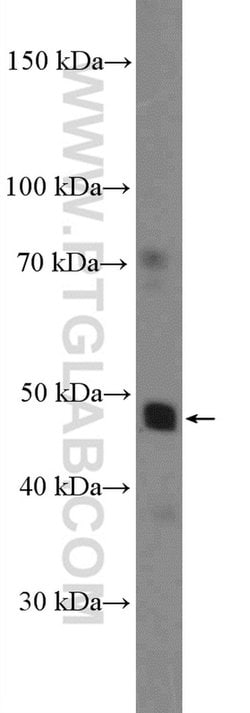 NR1H4 Rabbit anti-Human, Polyclonal, Proteintech:Antibodies:Primary Antibodies