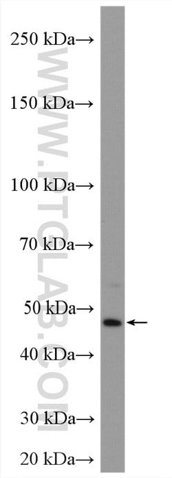 NR1H4 Rabbit anti-Human, Polyclonal, Proteintech:Antibodies:Primary Antibodies