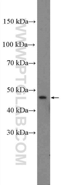 NR1H4 Rabbit anti-Human, Polyclonal, Proteintech:Antibodies:Primary Antibodies