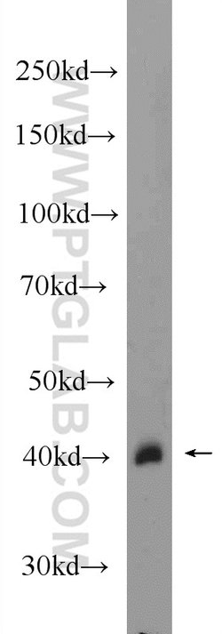 HAO1 Rabbit anti-Human, Mouse, Rat, Polyclonal, Proteintech 150 &mu;L;