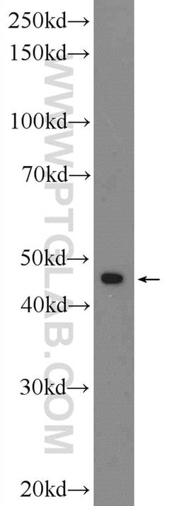 ARRDC3 Rabbit anti-Human, Polyclonal, Proteintech 150 &mu;L; Unconjugated:Antibodies,