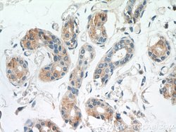 TGM5 Rabbit anti-Human, Mouse, Polyclonal, Proteintech 150 &mu;L; Unconjugated:Antibodies,