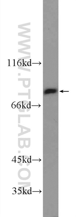 TGM5 Rabbit anti-Human, Mouse, Polyclonal, Proteintech 150 &mu;L; Unconjugated:Antibodies,