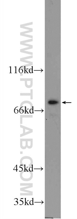 TGM5 Rabbit anti-Human, Mouse, Polyclonal, Proteintech 150 &mu;L; Unconjugated:Antibodies,