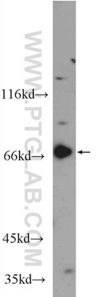 Thumbnail_GPR107 Rabbit anti-Human, Mouse, Polyclonal, Proteintech 20 &mu;L; Unconjugated:Antibodies