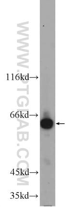 Thumbnail_GPR107 Rabbit anti-Human, Mouse, Polyclonal, Proteintech 20 &mu;L; Unconjugated:Antibodies