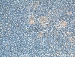 SIPA1L1 Rabbit anti-Human, Mouse, Polyclonal, Proteintech 20 &mu;L; Unconjugated:Antibodies,