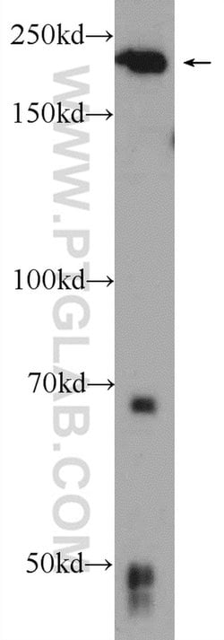 DOCK6 Rabbit anti-Human, Polyclonal, Proteintech:Antibodies:Primary Antibodies
