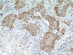 TMEM87A Rabbit anti-Human, Polyclonal, Proteintech:Antibodies:Primary Antibodies