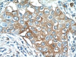 TMEM87A Rabbit anti-Human, Polyclonal, Proteintech:Antibodies:Primary Antibodies