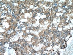 TMEM87A Rabbit anti-Human, Polyclonal, Proteintech:Antibodies:Primary Antibodies