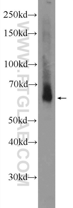 TMEM87A Rabbit anti-Human, Polyclonal, Proteintech:Antibodies:Primary Antibodies