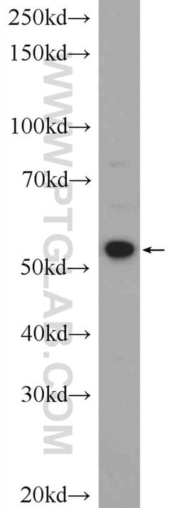 ZNF277 Rabbit anti-Human, Polyclonal, Proteintech:Antibodies:Primary Antibodies