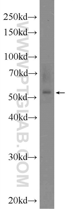 ZNF277 Rabbit anti-Human, Polyclonal, Proteintech:Antibodies:Primary Antibodies