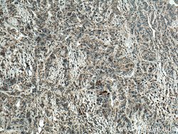 WFDC12 Rabbit anti-Human, Polyclonal, Proteintech:Antibodies:Primary Antibodies