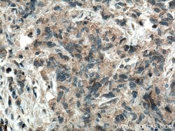 WFDC12 Rabbit anti-Human, Polyclonal, Proteintech:Antibodies:Primary Antibodies