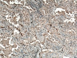 WFDC12 Rabbit anti-Human, Polyclonal, Proteintech:Antibodies:Primary Antibodies