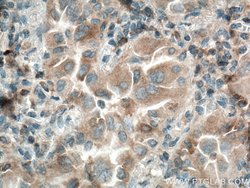 WFDC12 Rabbit anti-Human, Polyclonal, Proteintech:Antibodies:Primary Antibodies