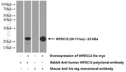 WFDC12 Rabbit anti-Human, Polyclonal, Proteintech:Antibodies:Primary Antibodies