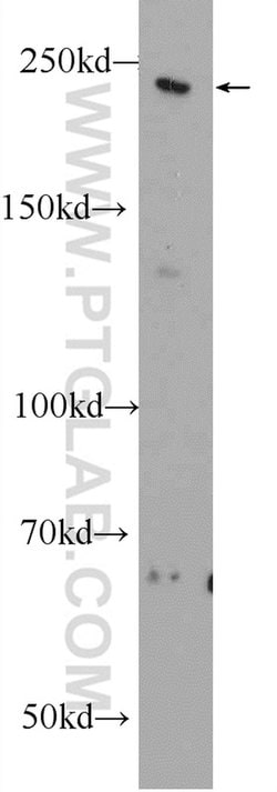 MYO16 Rabbit anti-Human, Rat, Polyclonal, Proteintech 150 &mu;L; Unconjugated:Antibodies,