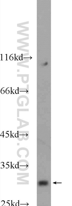 SHOX Rabbit anti-Human, Mouse, Polyclonal, Proteintech:Antibodies:Primary