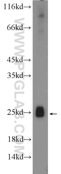 SHOX Rabbit anti-Human, Mouse, Polyclonal, Proteintech:Antibodies:Primary