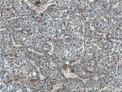 TPTE2 Rabbit anti-Human, Polyclonal, Proteintech 20 &mu;L; Unconjugated:Antibodies,