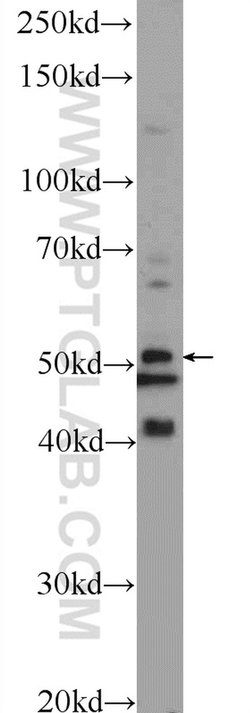 TPTE2 Rabbit anti-Human, Polyclonal, Proteintech 20 &mu;L; Unconjugated:Antibodies,