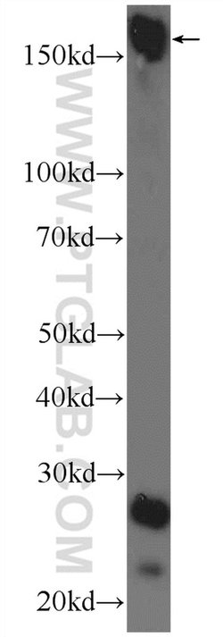 UHRF1BP1L Rabbit anti-Human, Mouse, Polyclonal, Proteintech 150 &mu;L | Buy Online | Proteintech Group Inc | Fisher Scientific